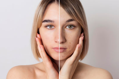 Anti-Pigmentation